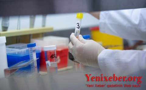  Bu ölkədə  pandemiya qurbanlarının sayı artıb