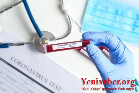 Rusiya koronavirus peyvəndini hazırladı —