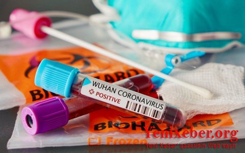 Azərbaycanda reanimasiyada olan koronavirus xəstələrinin sayı açıqlandı -