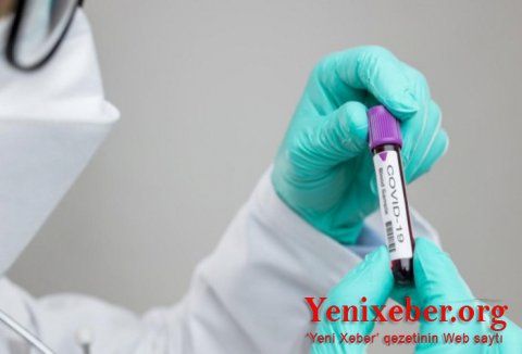 Koronavirusa yoluxanların sayı 15 milyona yaxınlaşır-
