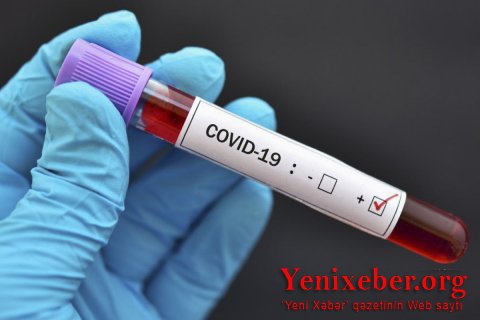 Ermənistanda COVID-19-a yoluxanların sayı 218 681 nəfərə çatıb