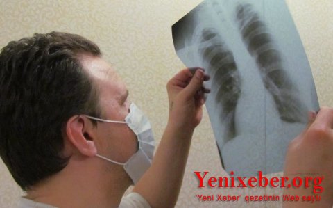 TƏBİB rəsmisi: